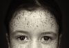 Judith Minks presenteert Freckles & more Judith Minks