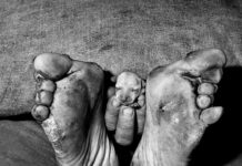 De wereld volgens Roger Ballen Roger Ballen